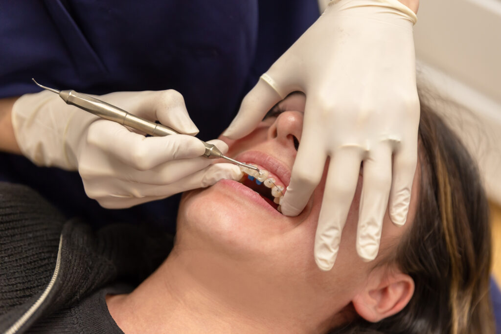 Cabinet Orthodontie Suresnes – Dr Nadia Kebaili – Chirurgien Dentiste – 29