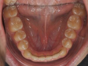 Dr Nadia Kebaili - Suresnes - othodontie esthetique - 1